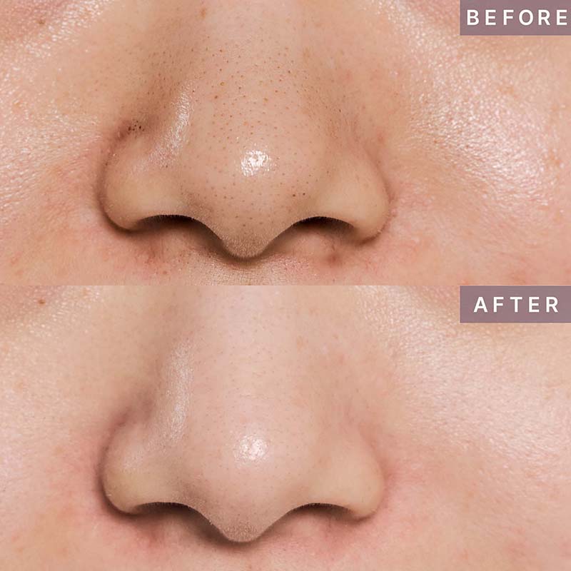 Pot Pore Peptamin Wash Off Pack