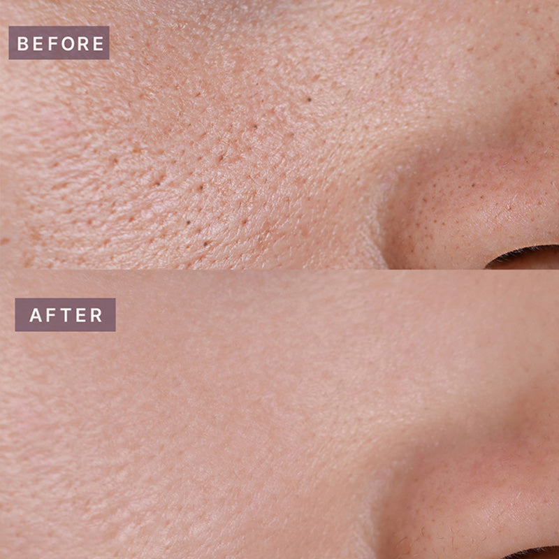 Pot Pore Tightening Podo Ampoule